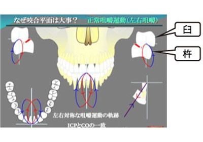 噛み合わせが悪いとお口全体が不健康になります